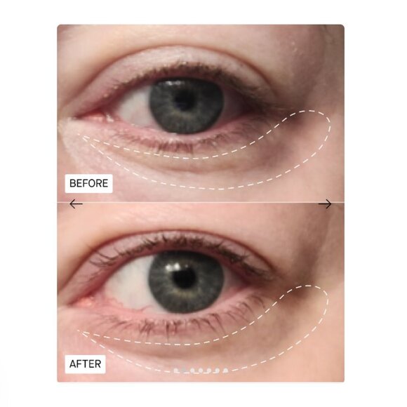H30 Fibroquin™ Advanced Firming Eye Cream - Picture 2 of 3